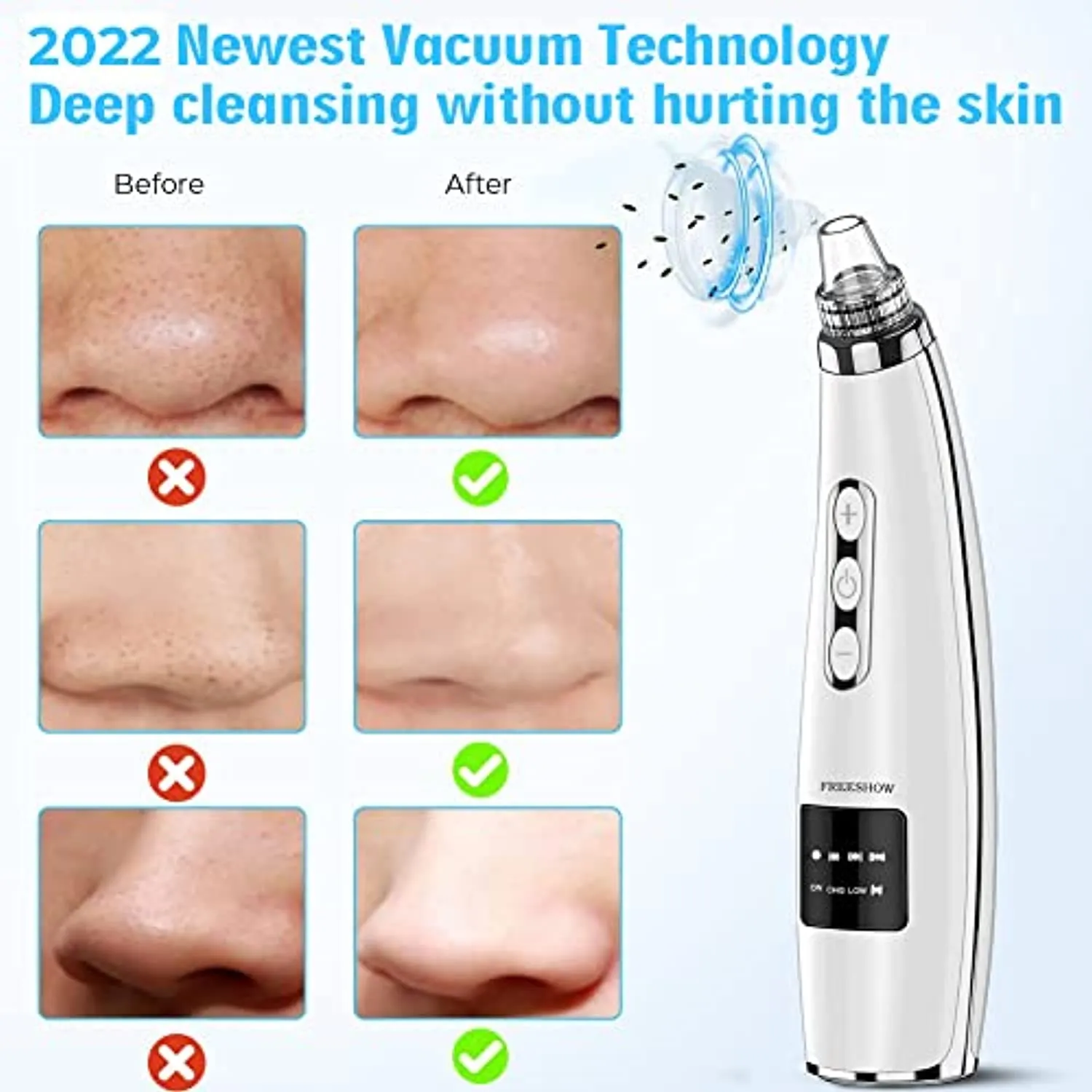 2022 Newest Blackhead Remover Pore Vacuum,Upgraded Facial Pore Cleaner,Electric Acne Comedone Whitehead Extractor Tool-5 Suction Power,5 Probes,USB Rechargeable Blackhead Vacuum Kit for Women & Men