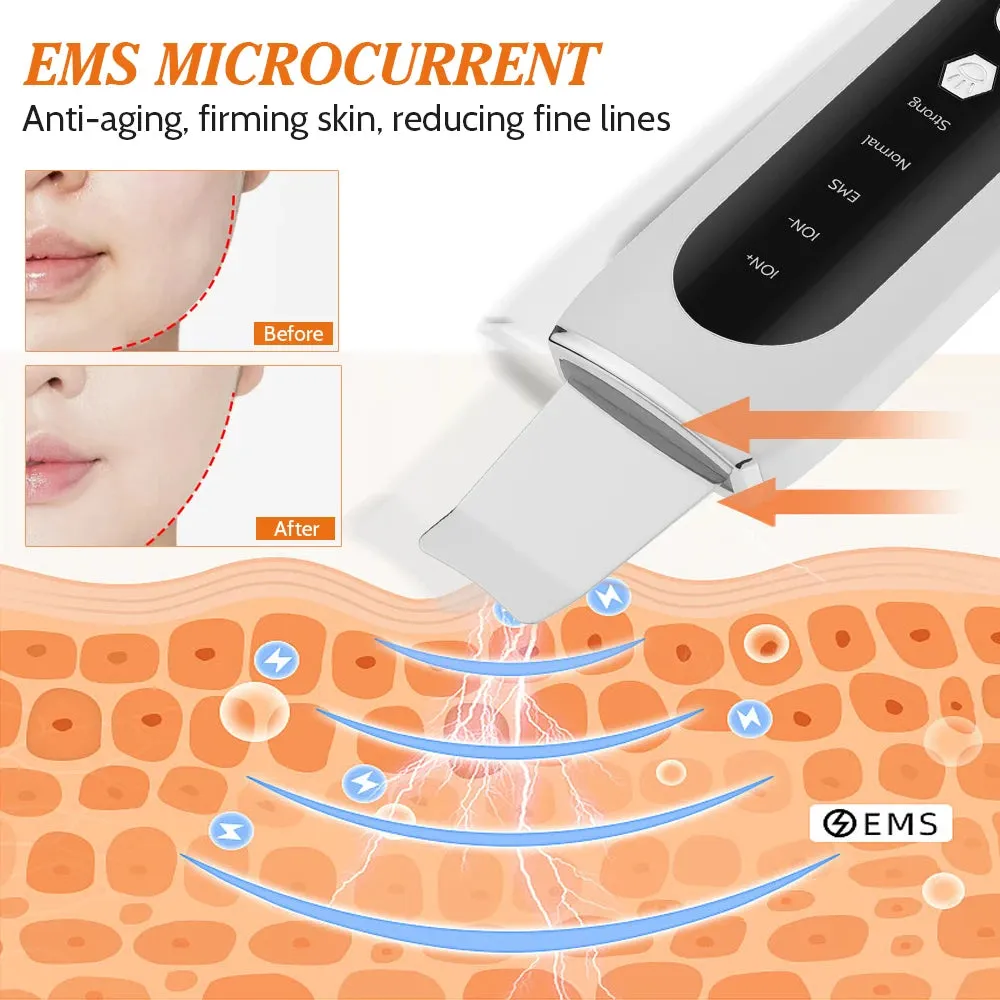 2024 Ultrasonic Face Scrubber – USB Rechargeable Skin Lifting & Pore Cleansing Tool, Blackhead Remover with Ion Technology