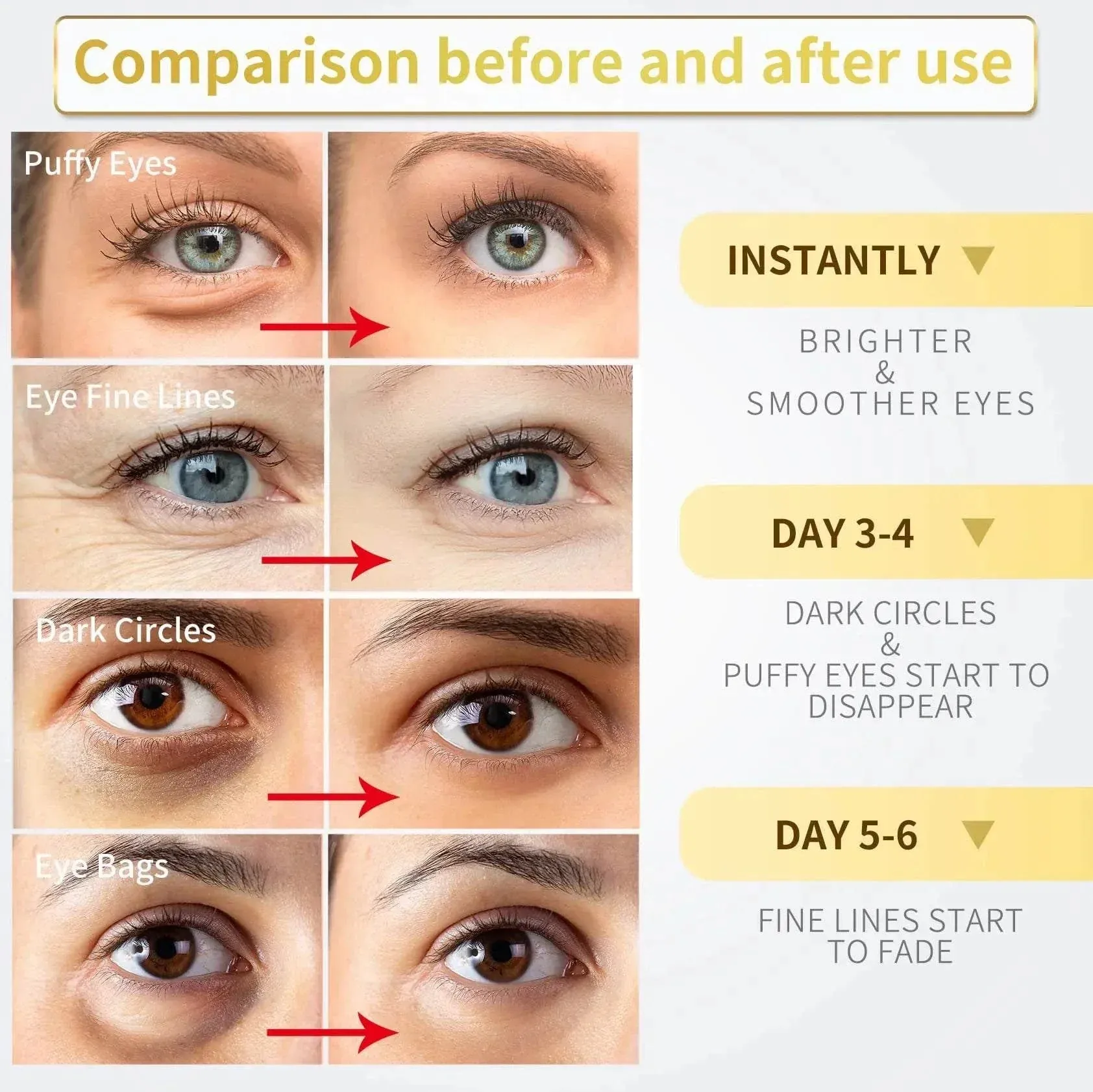 24K Gold Eye Mask- Luxury Anti-Aging Under Eye Treatment