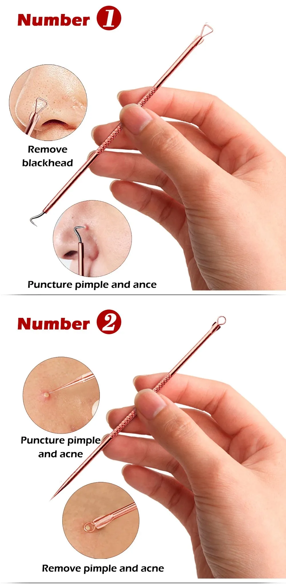 4 pcs Blackhead Remover/Pimple Comedone Extractor Tool Set