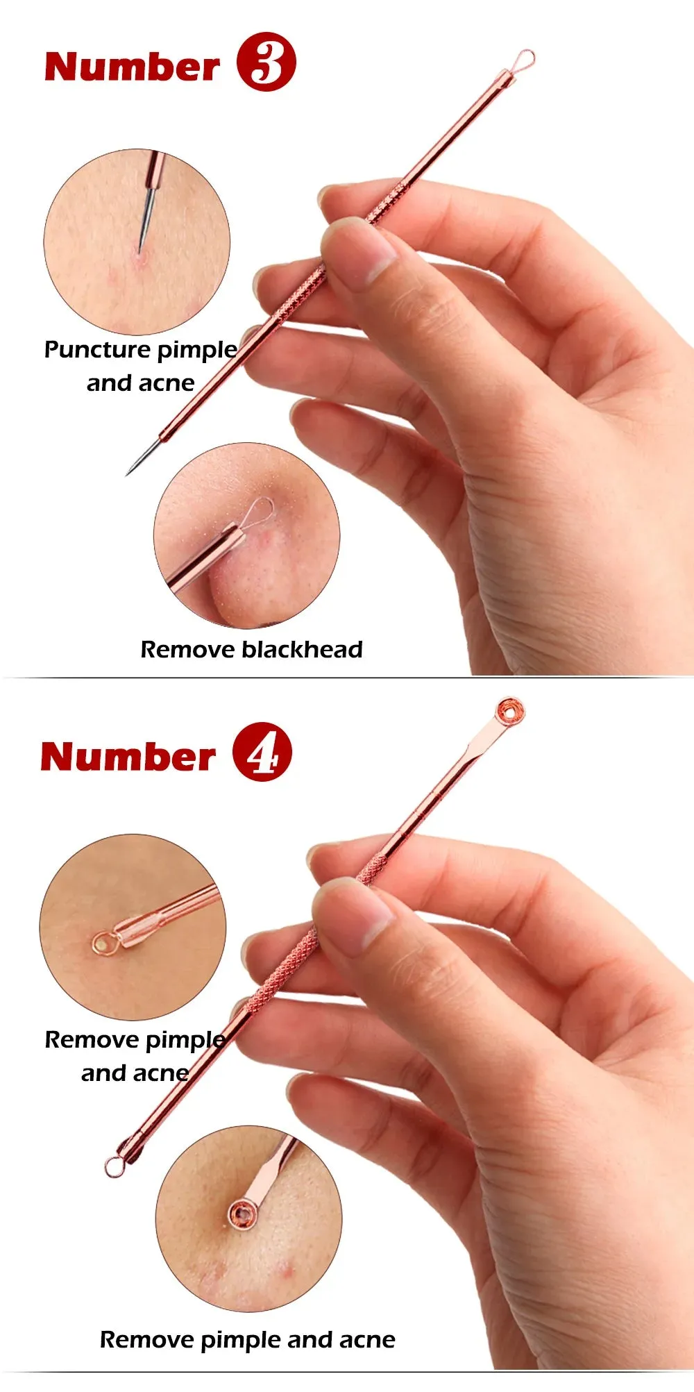 4 pcs Blackhead Remover/Pimple Comedone Extractor Tool Set