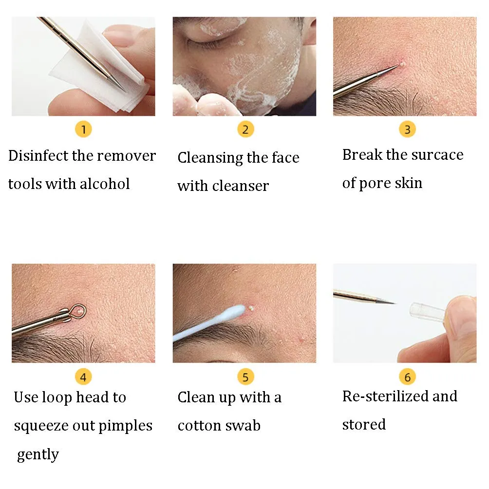 8 Pcs Stainless Steel Blackhead Remover Pimple Extractor Tool Kit with Metal Case for Pimples, Blackheads, Zit Removing for Face Nose