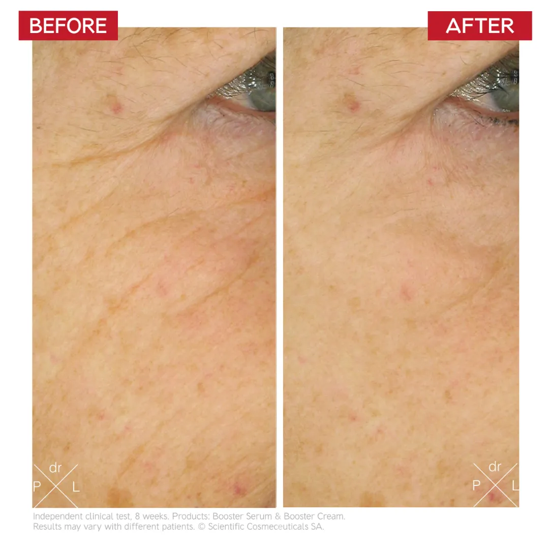 Age-Reverse Stem Cell Cure