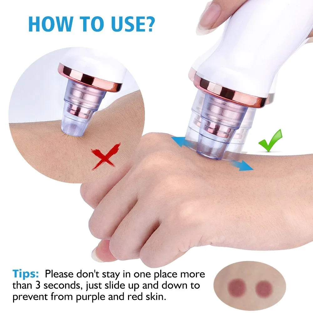 Aibeau Blackhead Remover Electric Blackhead Vacuum Suction Rechargeable Whitehead Remover Tool Kite Cleanser with 4 Replaceable Heads, Hot Pack Function and 3 Modes