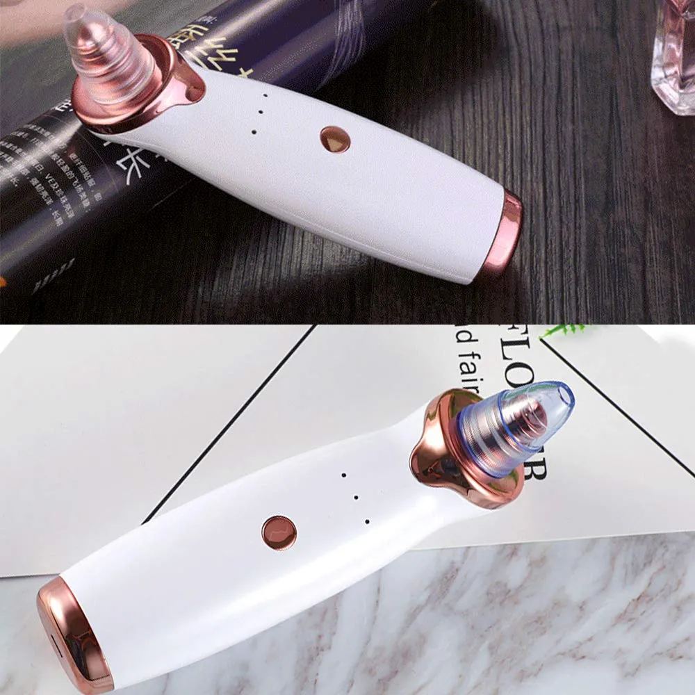 Aibeau Blackhead Remover Electric Blackhead Vacuum Suction Rechargeable Whitehead Remover Tool Kite Cleanser with 4 Replaceable Heads, Hot Pack Function and 3 Modes