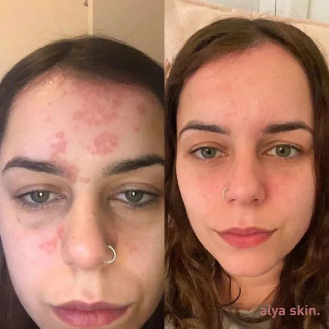 ALYA SKIN Pink Clay Mask