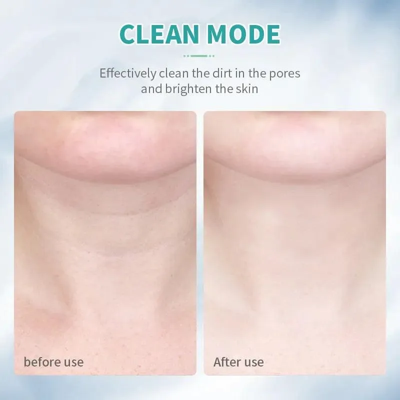 ANLAN Neck Face Beauty Device