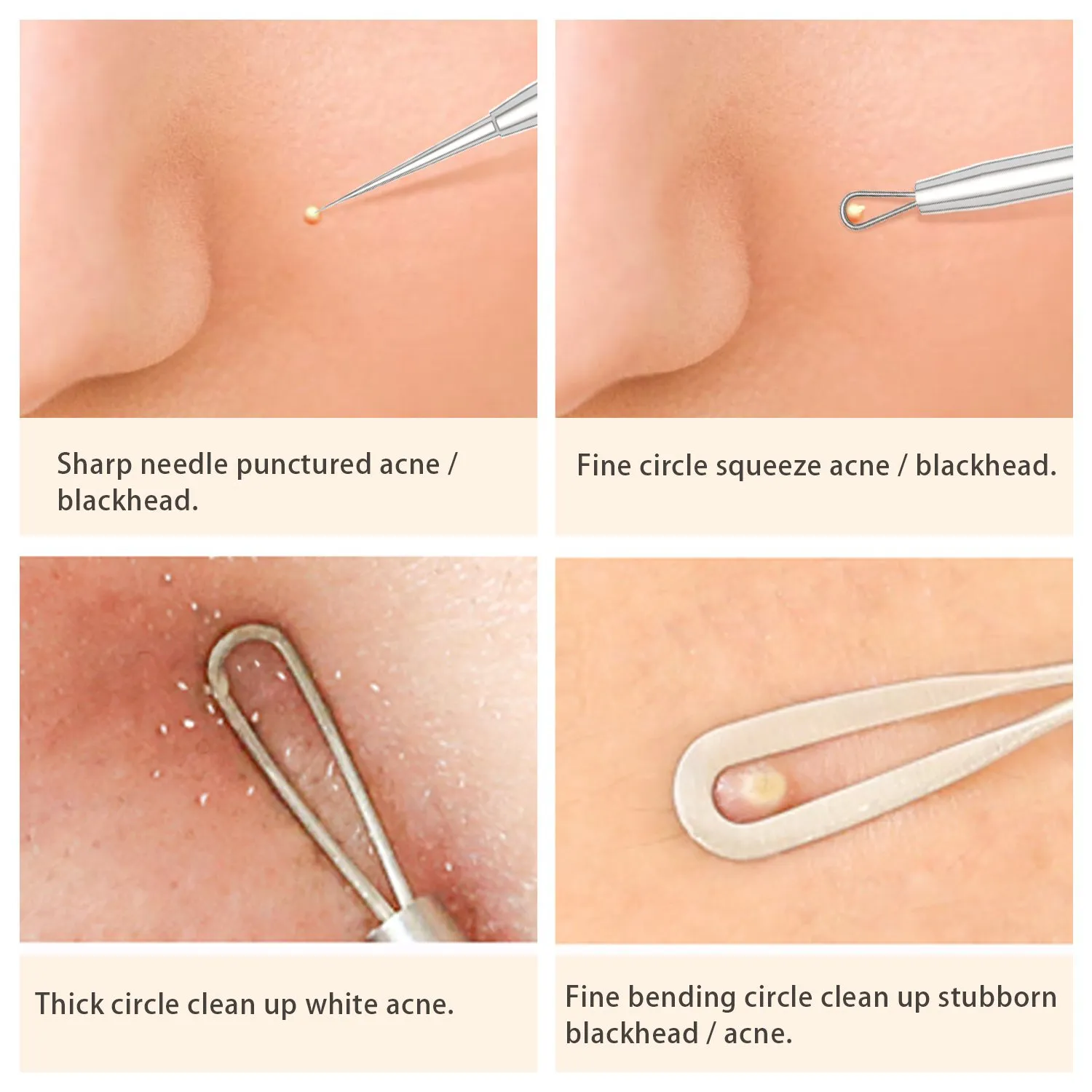 BESTOPE Blackhead Remover Pimple Popper Tool Kit Acne Comedone Zit Blackhead Extractor Tool for Nose Face, Blemish Whitehead Extraction Popping,Stainless Steel with Metal Case