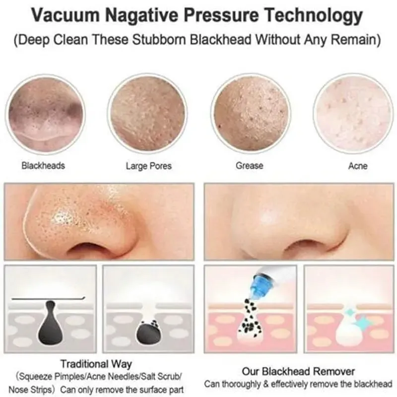 Blackhead Remover Instrument