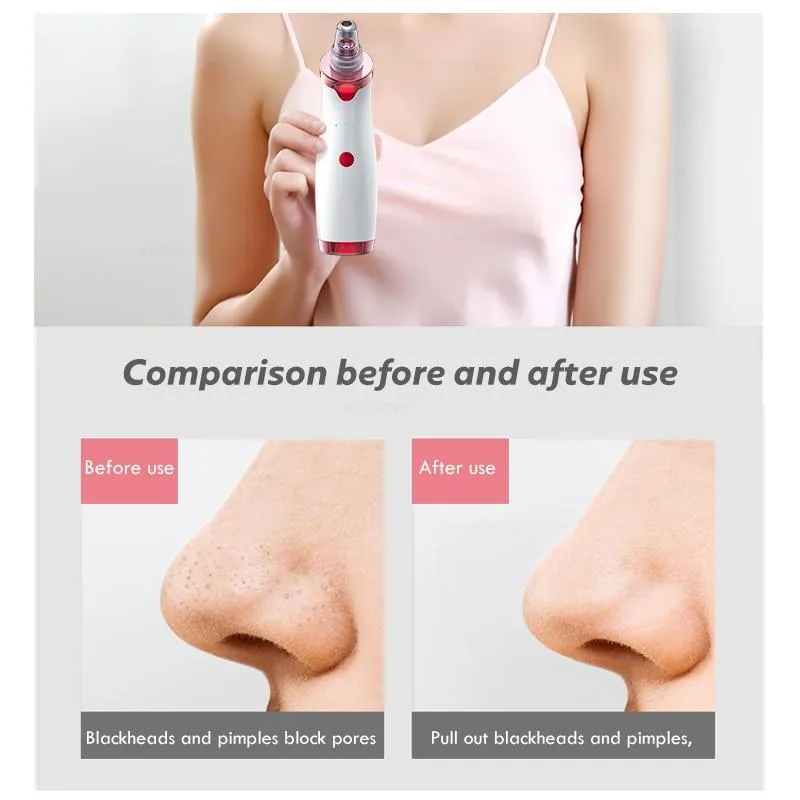 Blackhead Remover   Nano Mist Spray