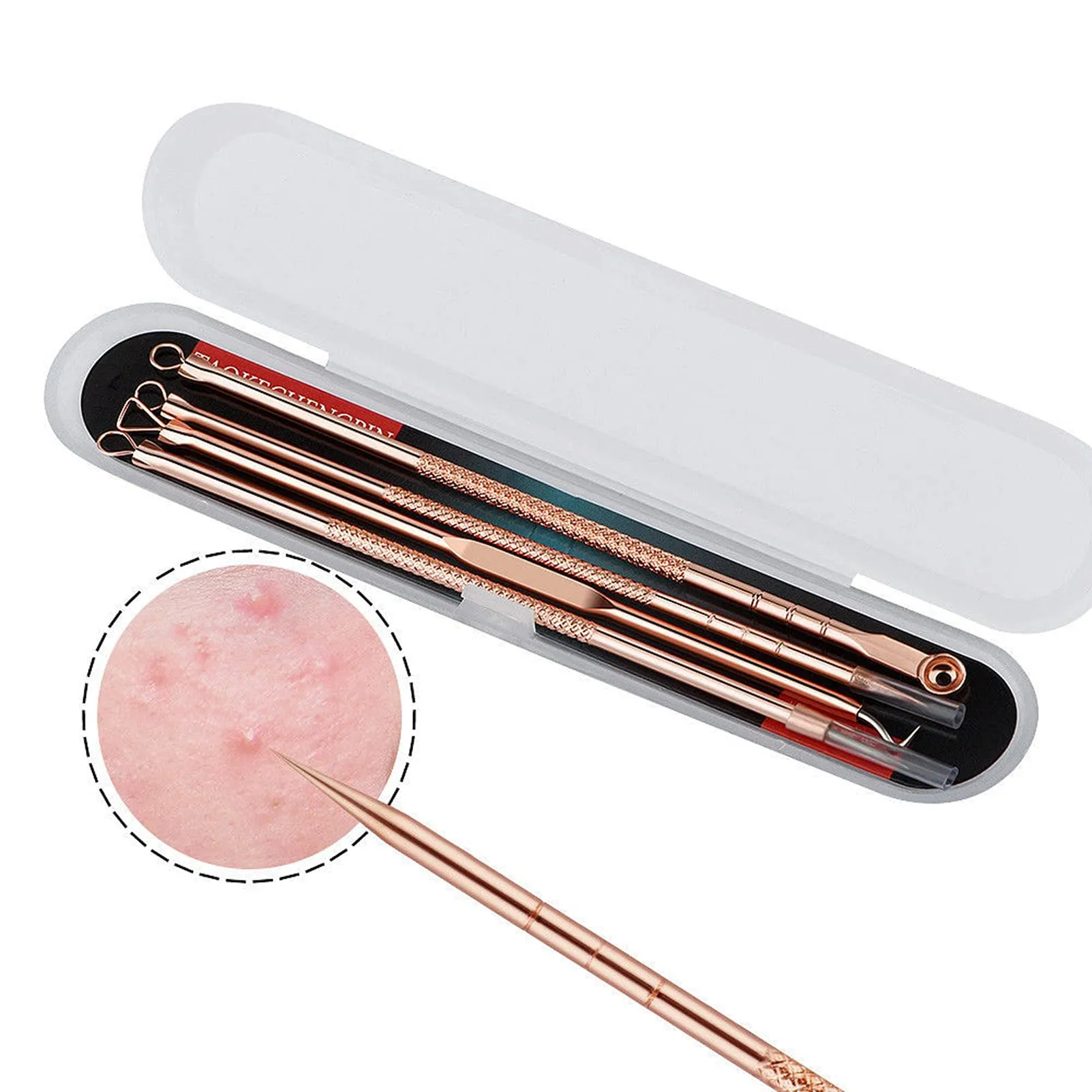 Blackhead Remover Tool Kit,4 Pieces Comedone Extractor Tool Blemish Whitehead Removal Acne Needle Pimple Spot Popper Stainless Steel (Gold) Gold