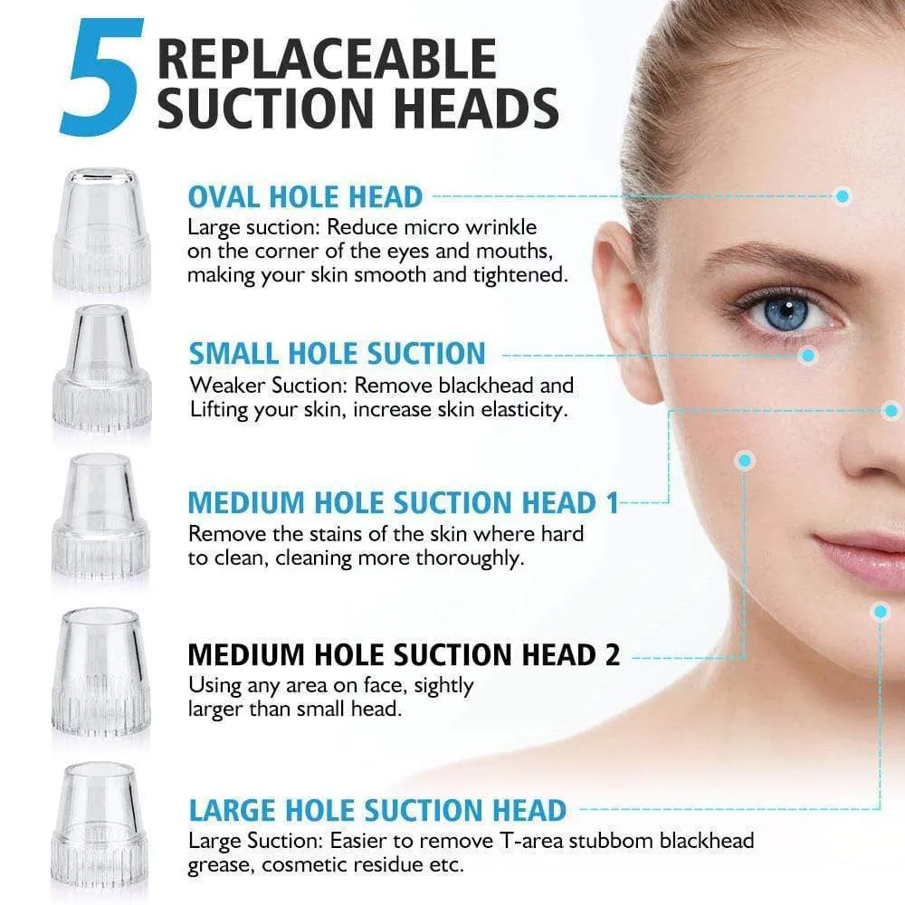 Blackhead Remover Vacuum - Pimple & Acne Suction Tool