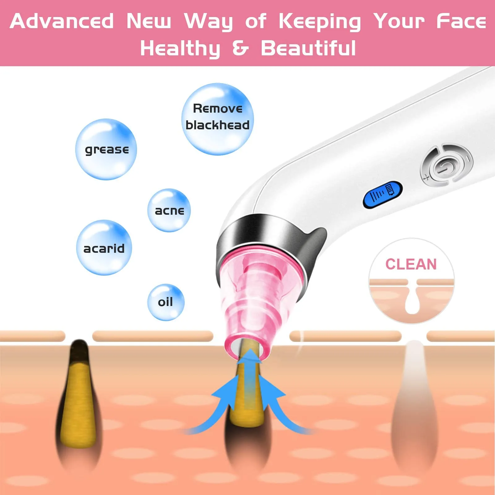 Blackhead Remover Vacuum, POPPYO Blackhead Pore Vacuum, Electric Facial Blackhead & Blemish Removers Cleaner, Blackhead Vacuum for Women（Pink) Pink