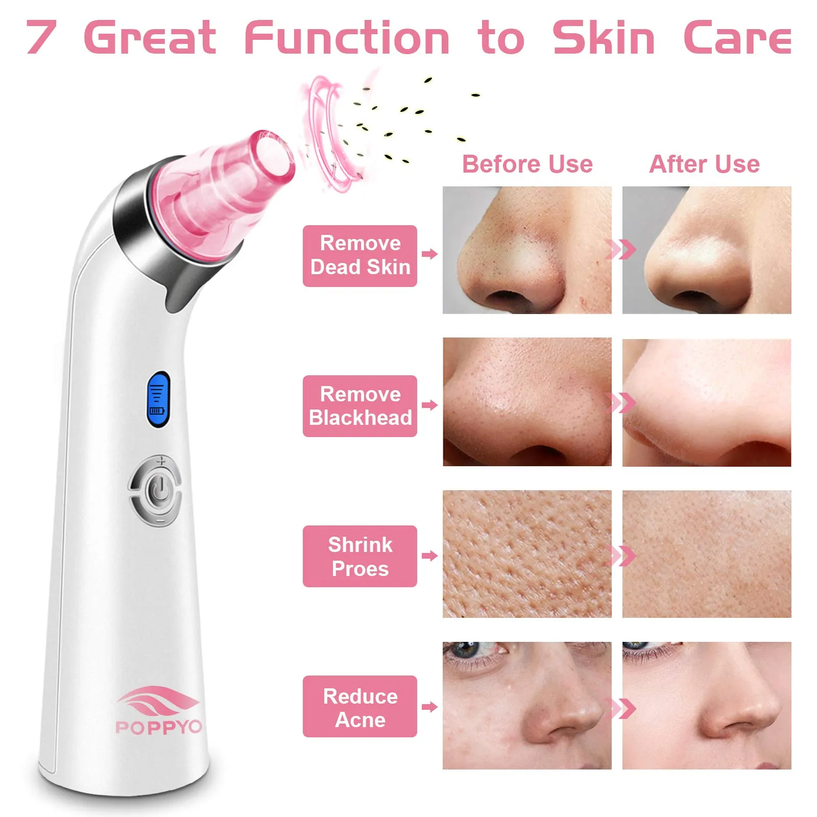 Blackhead Remover Vacuum, POPPYO Blackhead Pore Vacuum, Electric Facial Blackhead & Blemish Removers Cleaner, Blackhead Vacuum for Women（Pink) Pink