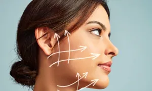 Choice of Fractional Skin Tightening Sessions at Ri Aesthetics