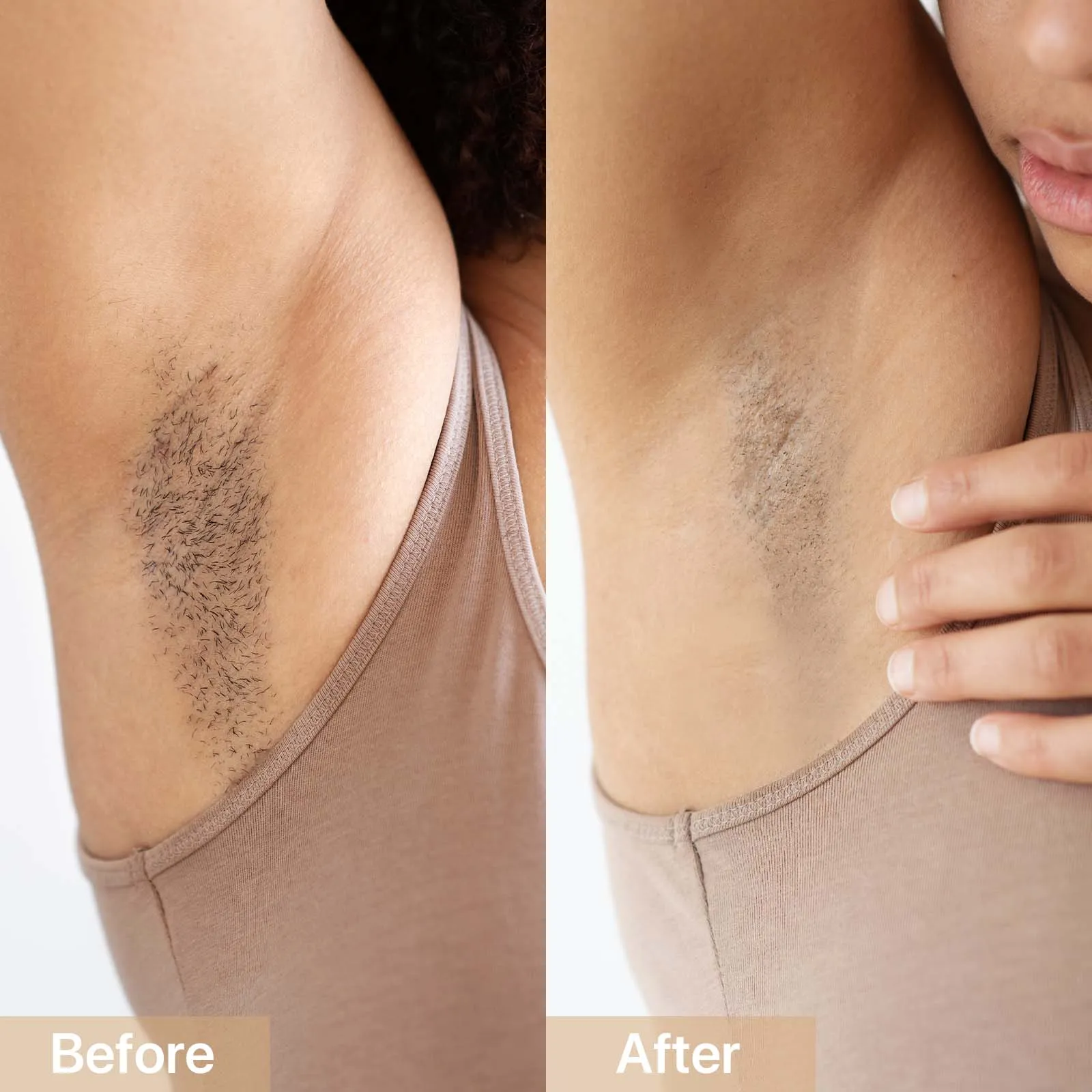 [CLEARANCE] AMIRO Opal IPL Hair Removal Handset