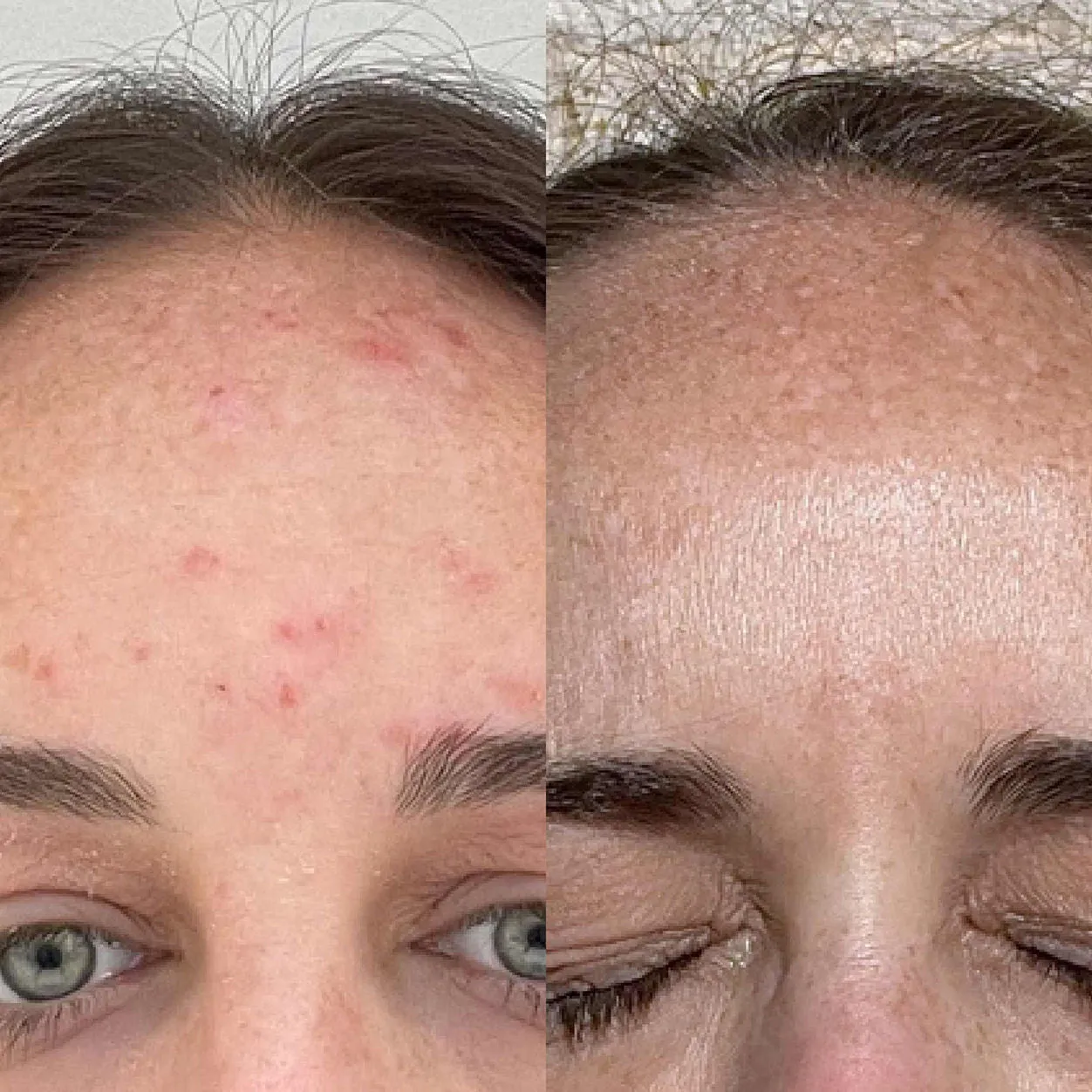 ClearBalm Power Elixir