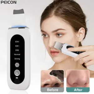 Deep Cleaning Ultrasonic Blackhead Remover and Facial Cleanser