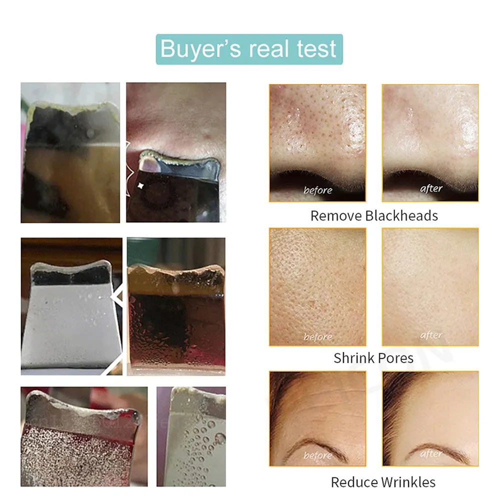 Deep Cleaning Ultrasonic Blackhead Remover and Facial Cleanser