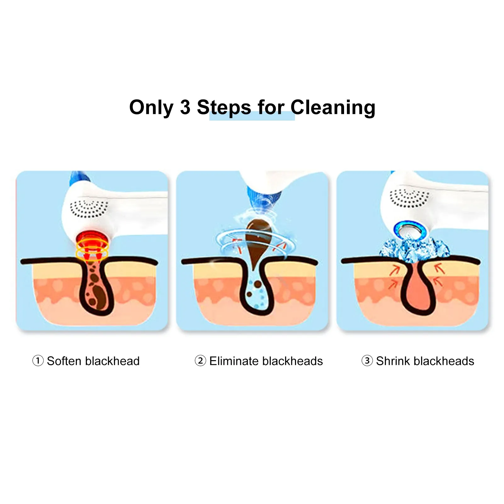 Electric Blackhead Suction Device