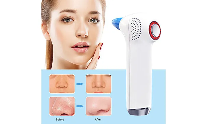 Electric Blackhead Suction Device