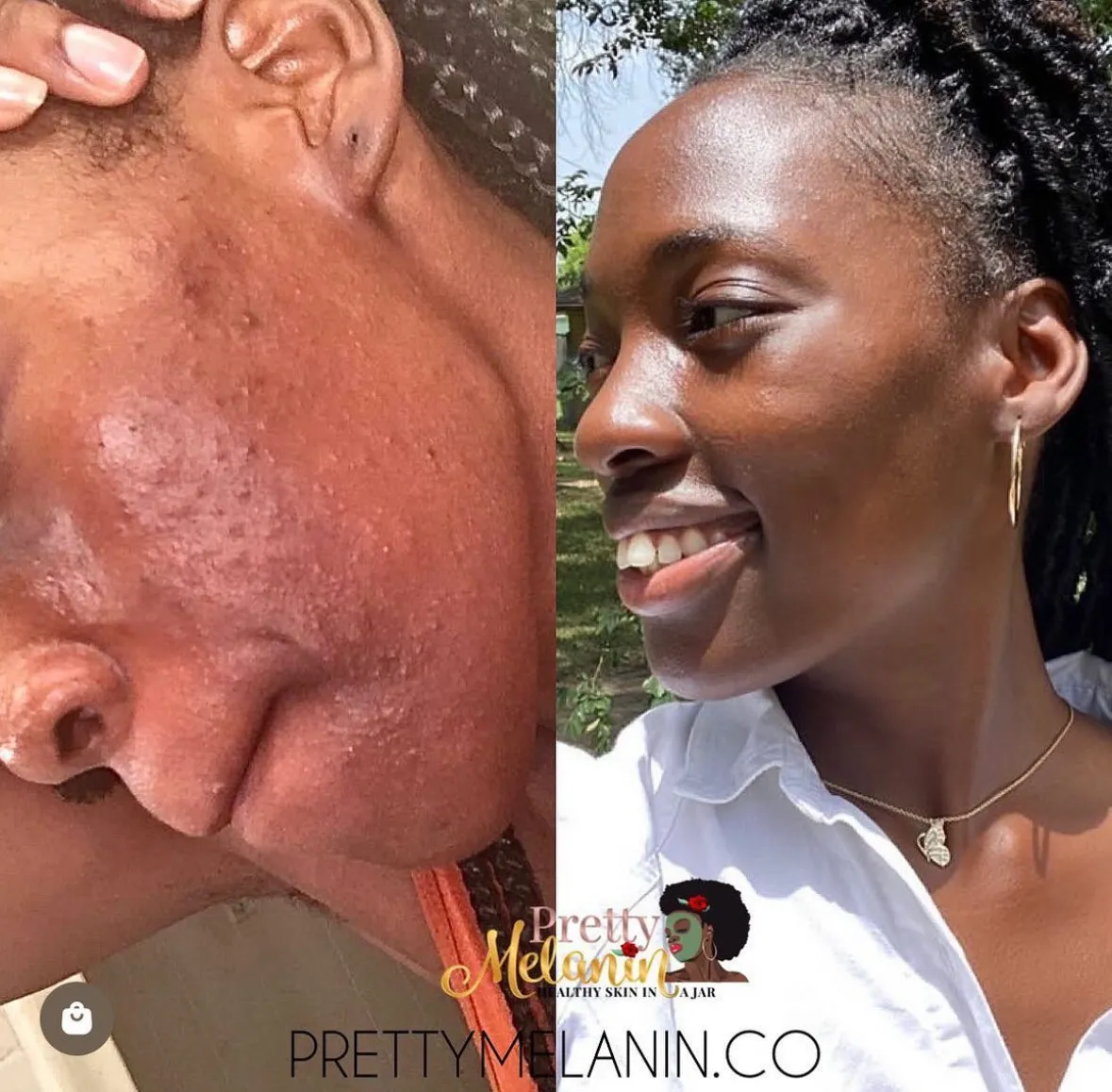 Face Scrub (EXFOLIATION)