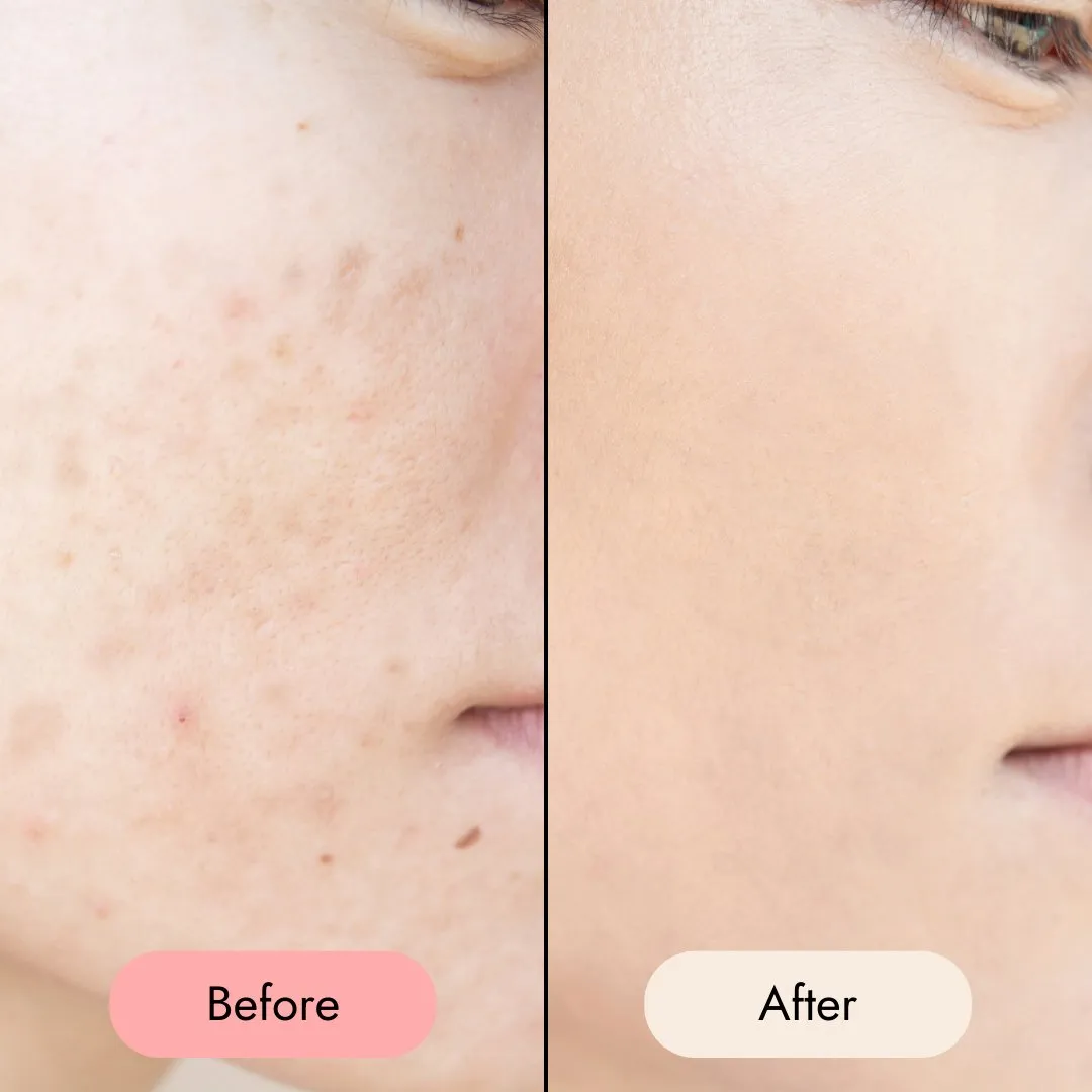 Gentle Cleansing Milk