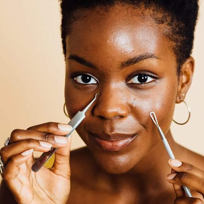 Grace & Stella Blackhead Remover Tools Kit