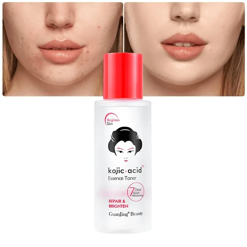 Guanjing Beauty Kojic Acid Repair & Brighten Essence Toner - 100ml