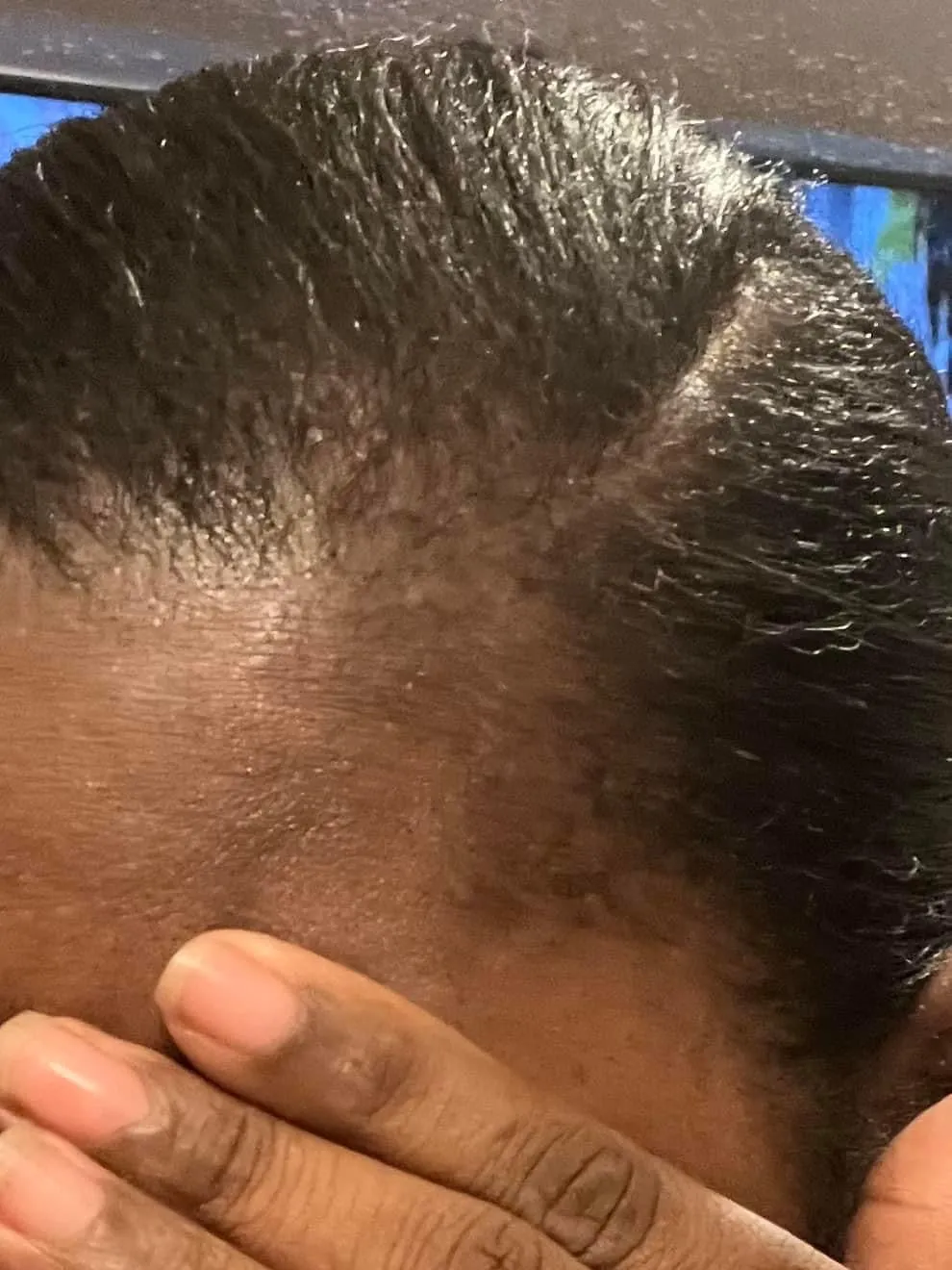 Hair Growth Oil