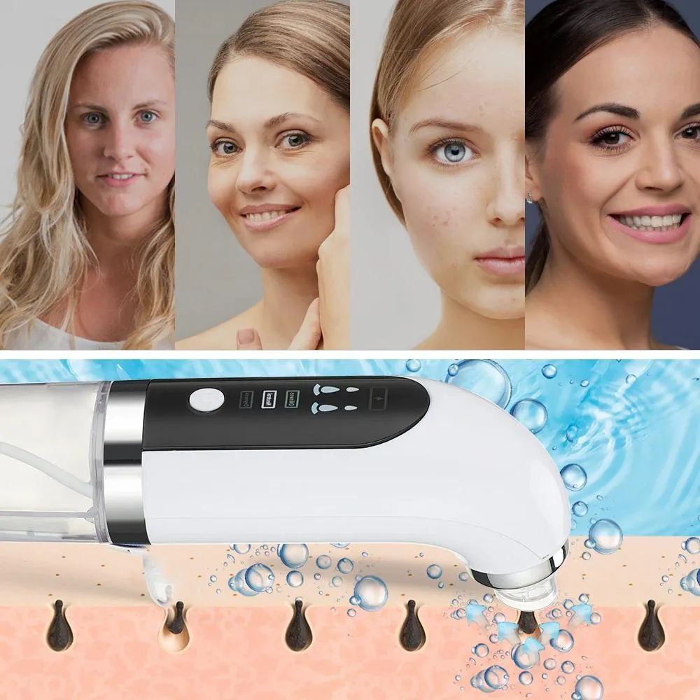 Hydrodermabrasion Device Blackhead Remover & Facial Cleanser