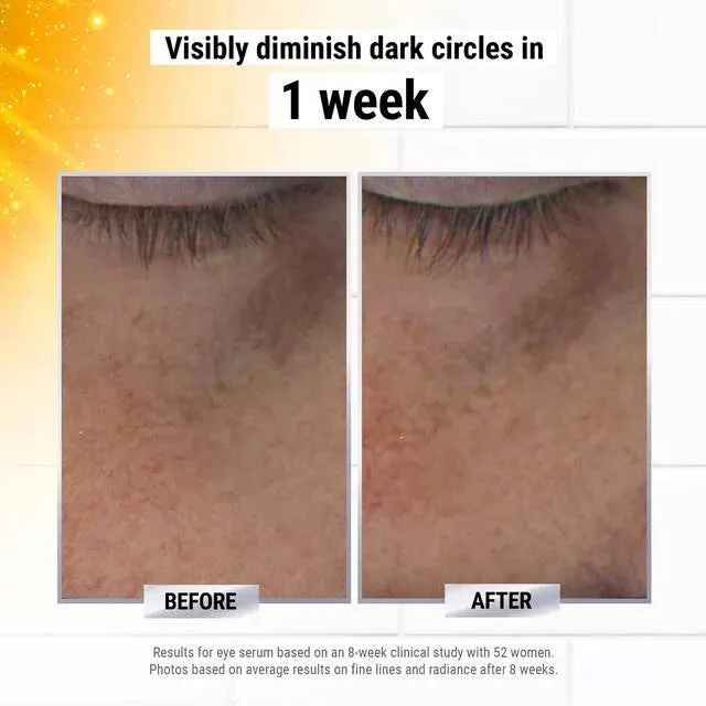 Kiehl's dermatologist solutions powerful strength line reducing and dark circles dimensioning vitamin C eye Serum سيروم العين لعلاج الخطوط والهالات من كيلز