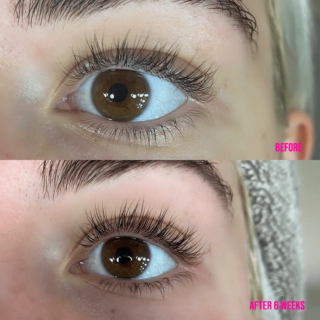 Lash Treatment Serum