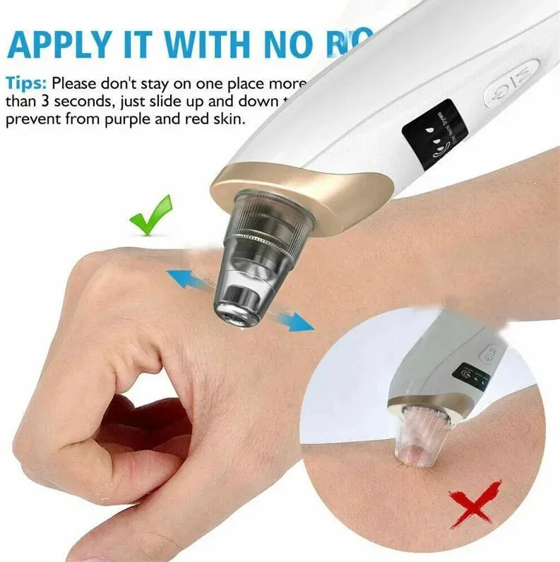 Miss Beauty 5 in 1 Rechargeable Digital Blackhead Remover   Facial Steamer For Face Steam & Inhaler