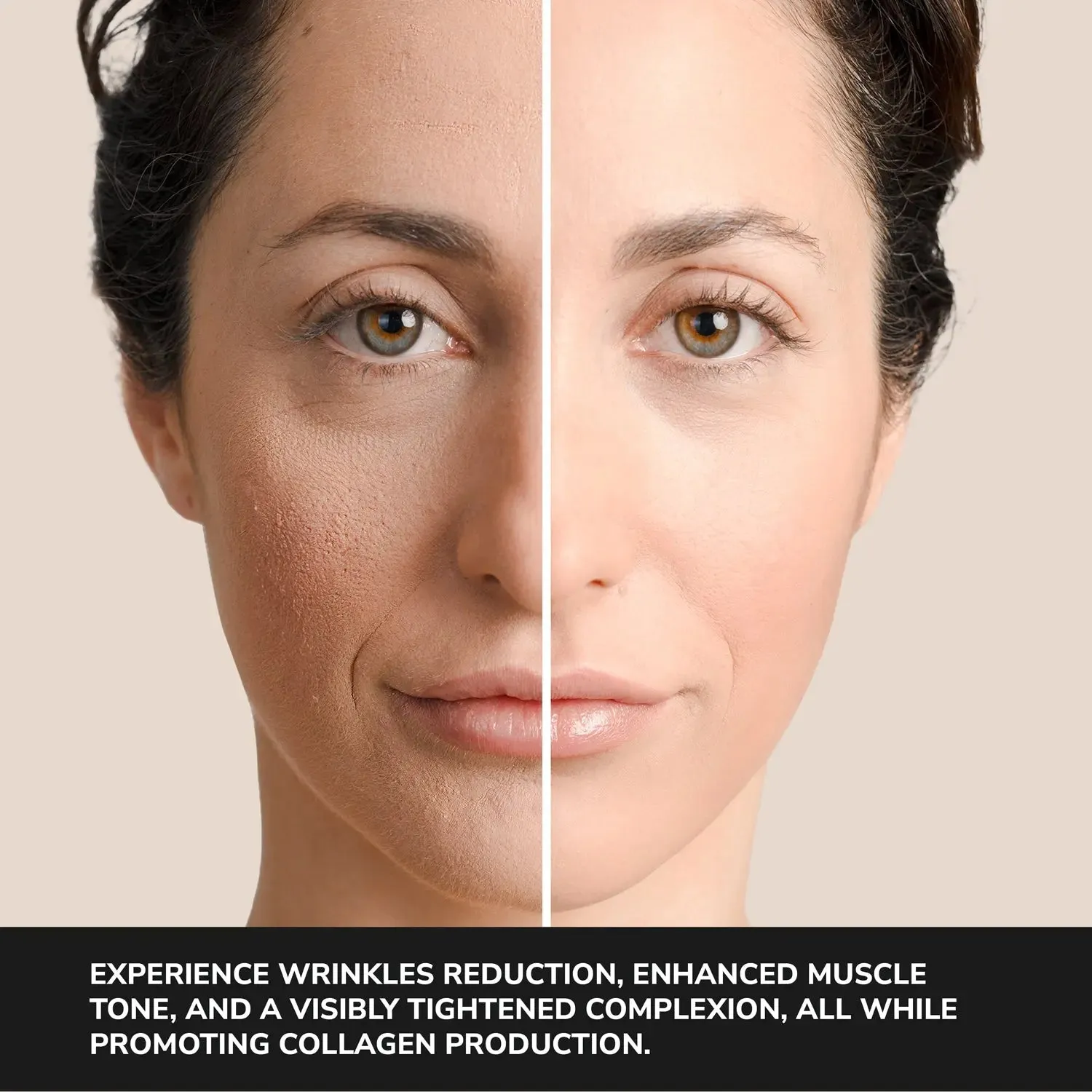 ODELYNE® ILLUME™ | Face Massager | RF Radio Frequency Skin Tightening Device for At-Home EMS Microcurrent Facial Toning & Collagen Boosting