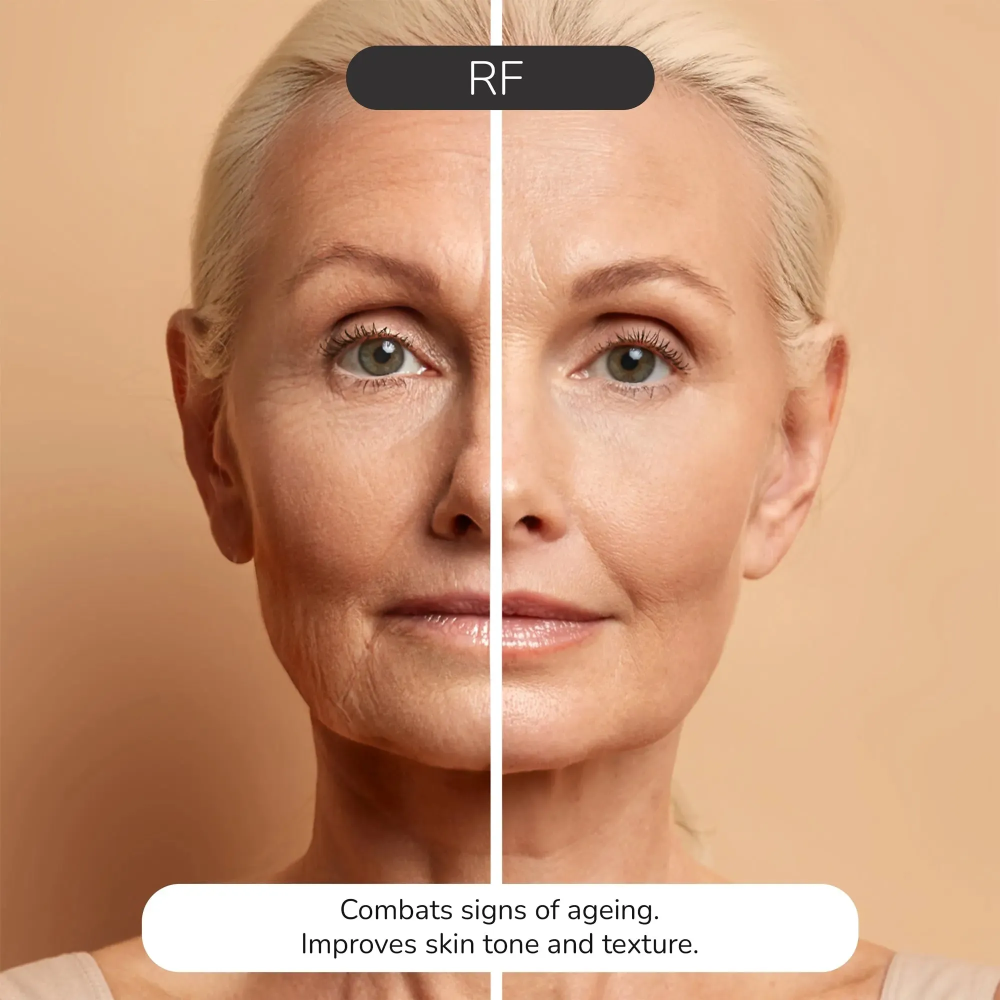 ODELYNE® ILLUME™ | Face Massager | RF Radio Frequency Skin Tightening Device for At-Home EMS Microcurrent Facial Toning & Collagen Boosting
