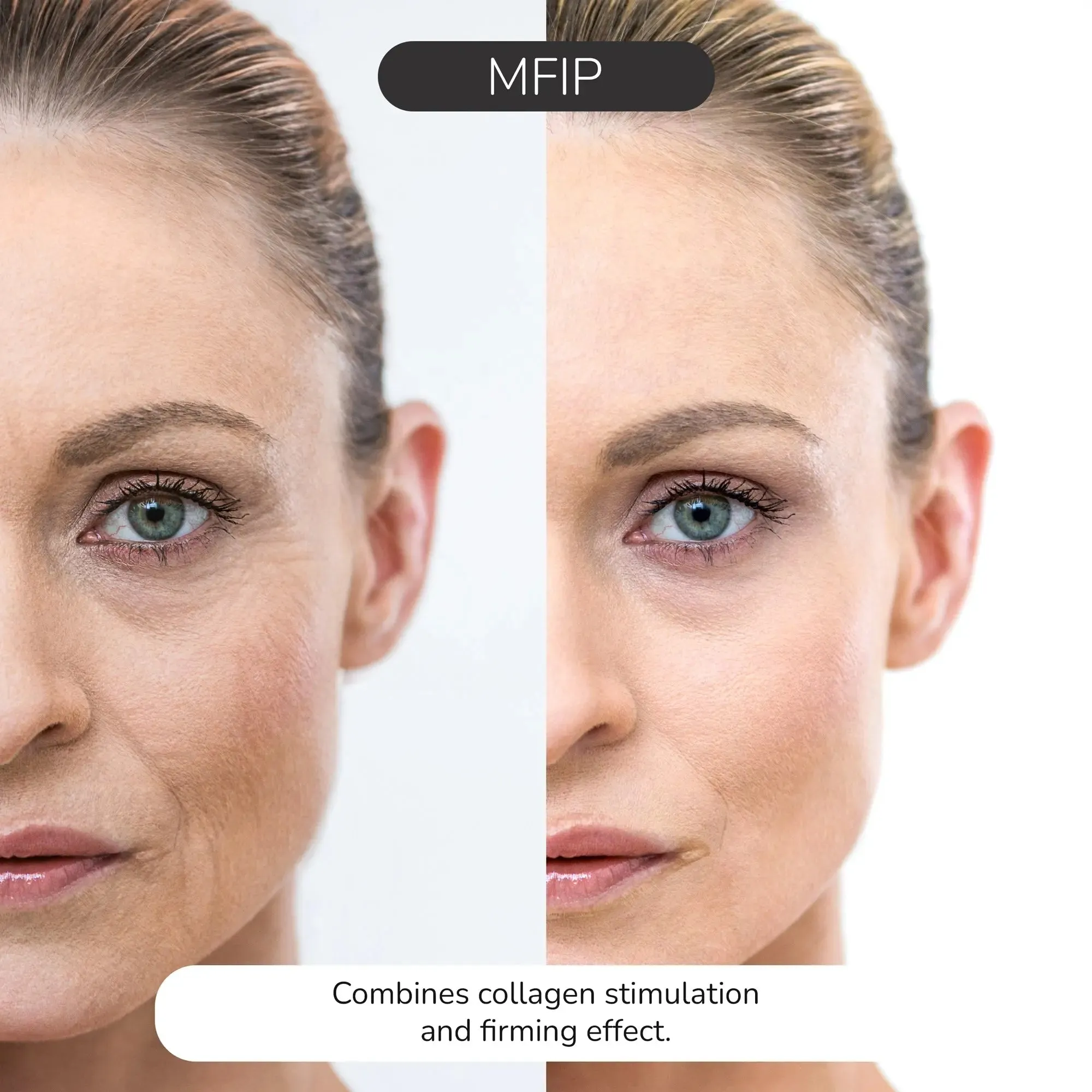 ODELYNE® ILLUME™ | Face Massager | RF Radio Frequency Skin Tightening Device for At-Home EMS Microcurrent Facial Toning & Collagen Boosting