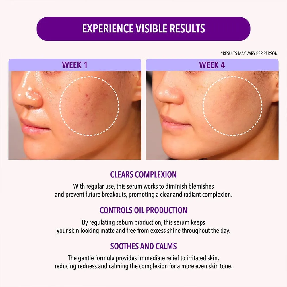Oil Control Serum (1 unit)