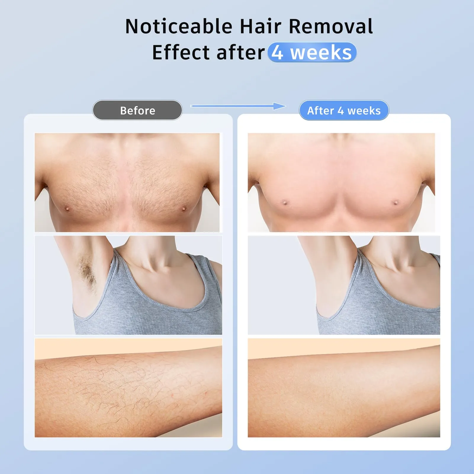 Painless IPL Laser Hair Removal Device with Cooling