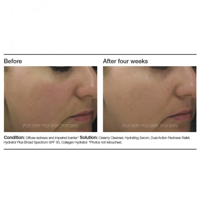 PCA Dual Action Redness Relief