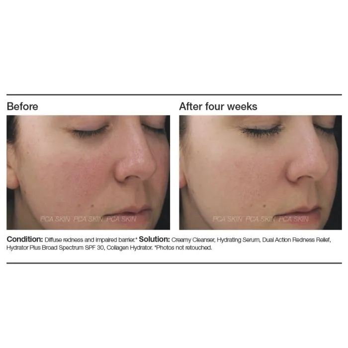 PCA Skin Dual Action Redness Relief