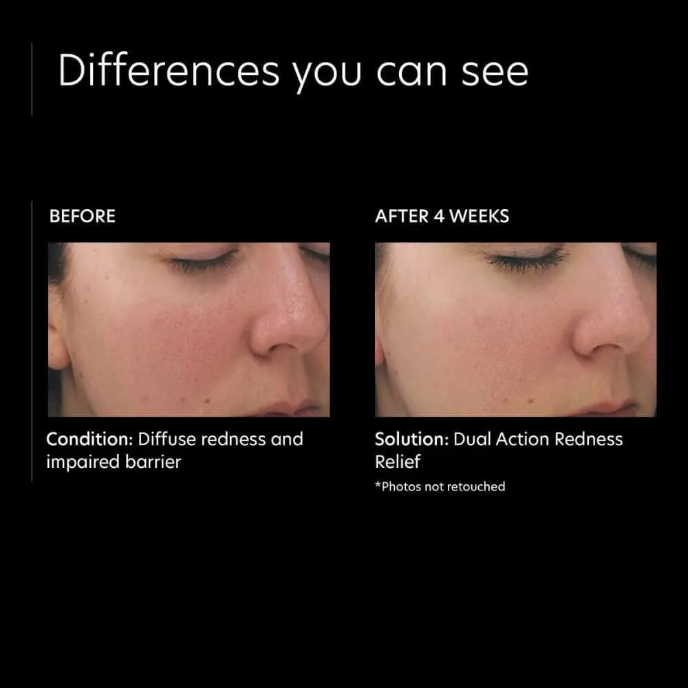 PCA Skin Dual Action Redness Relief