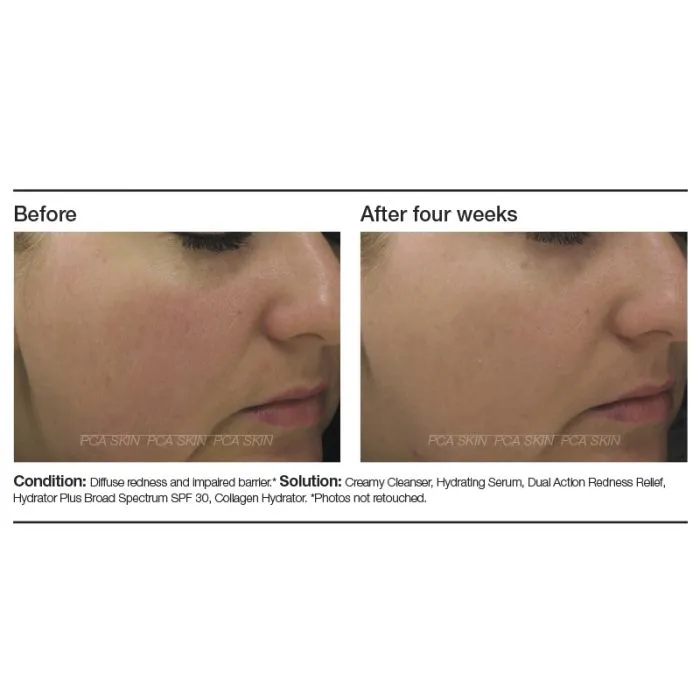 PCA Skin Dual Action Redness Relief