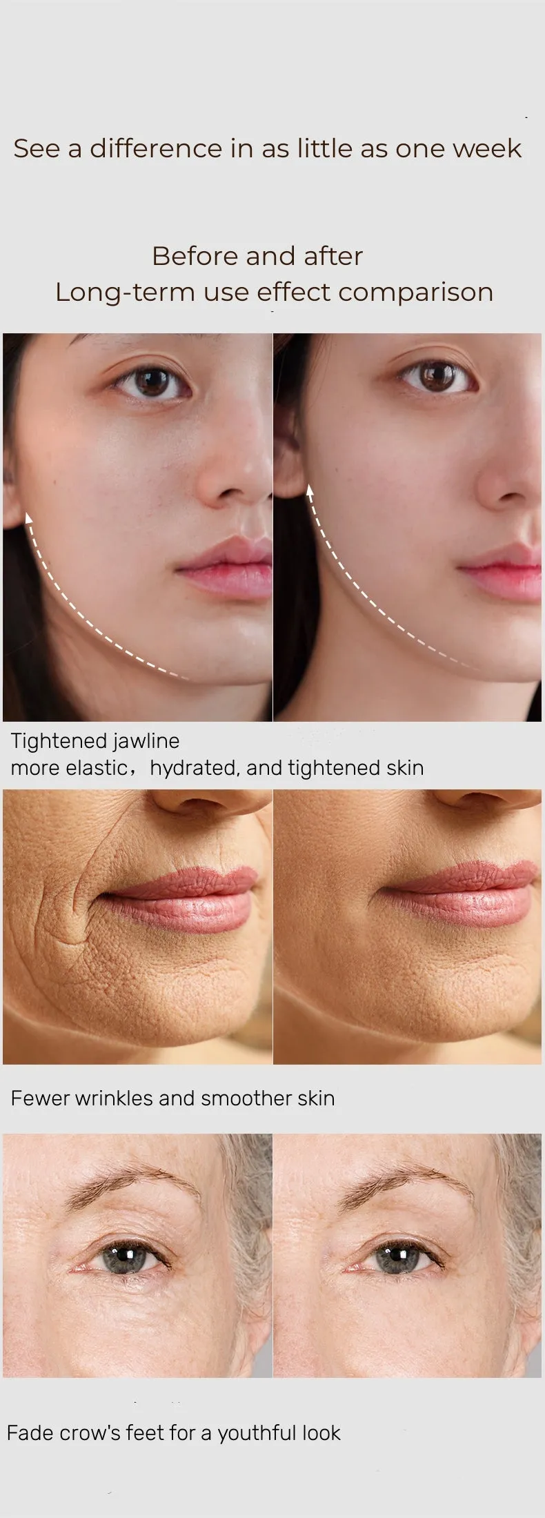 PL038 Prospera RF Radio Frequency 5 in 1 EMS Micro Current LED Light Facial Body Anti Aging Massage Device