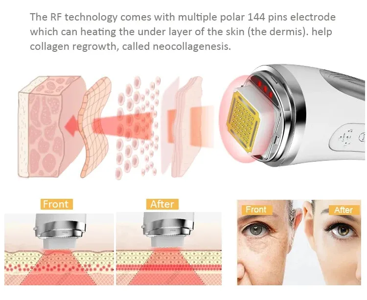 Radio Frequency Facial Lifting Machine Dot Matrix Wrinkle Removal SKin Tightening RF High Frequency Facial Care Device