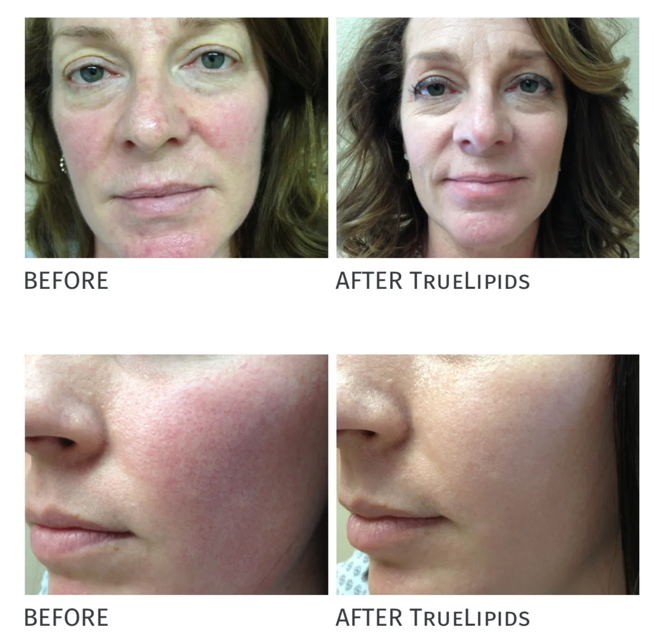 Redness Relief Kit