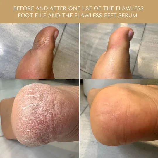 Serum Doctor Flawless Feet System