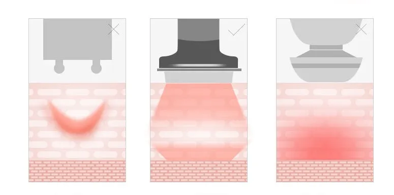 Skin Tightening RF Massager