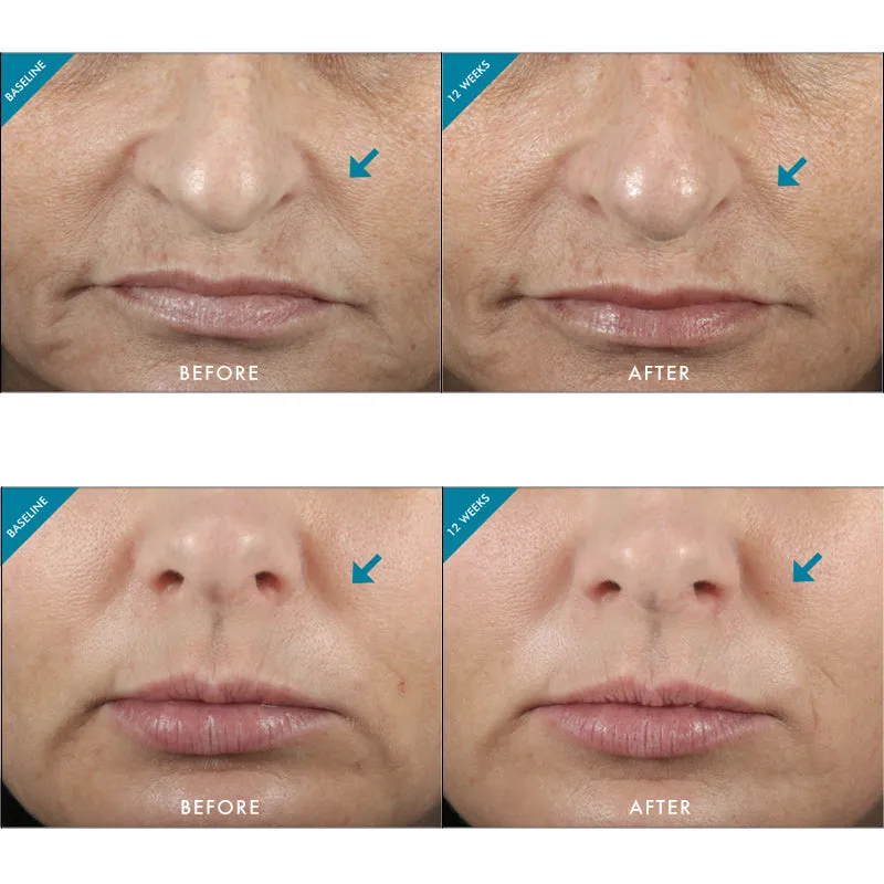 SkinCeuticals Metacell Renewal B3