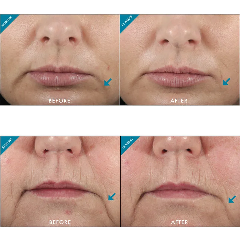 SkinCeuticals Metacell Renewal B3